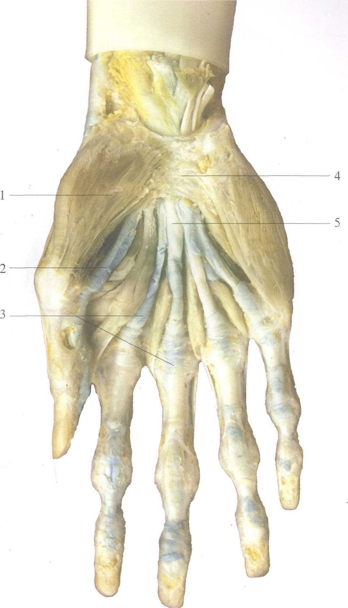 图  手掌部肌和腱滑液鞘