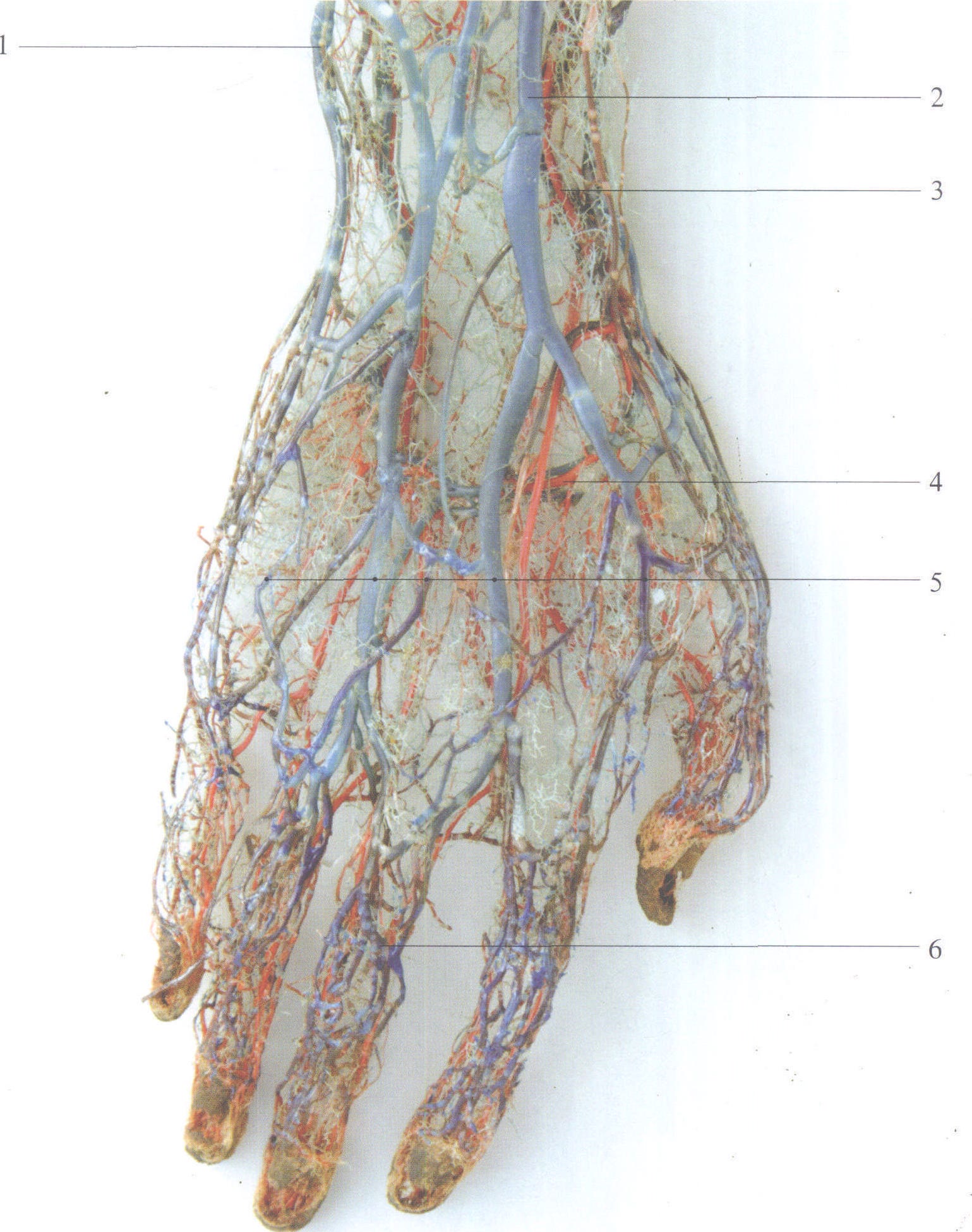 图3-199 手部血管铸型(背面观)(1)