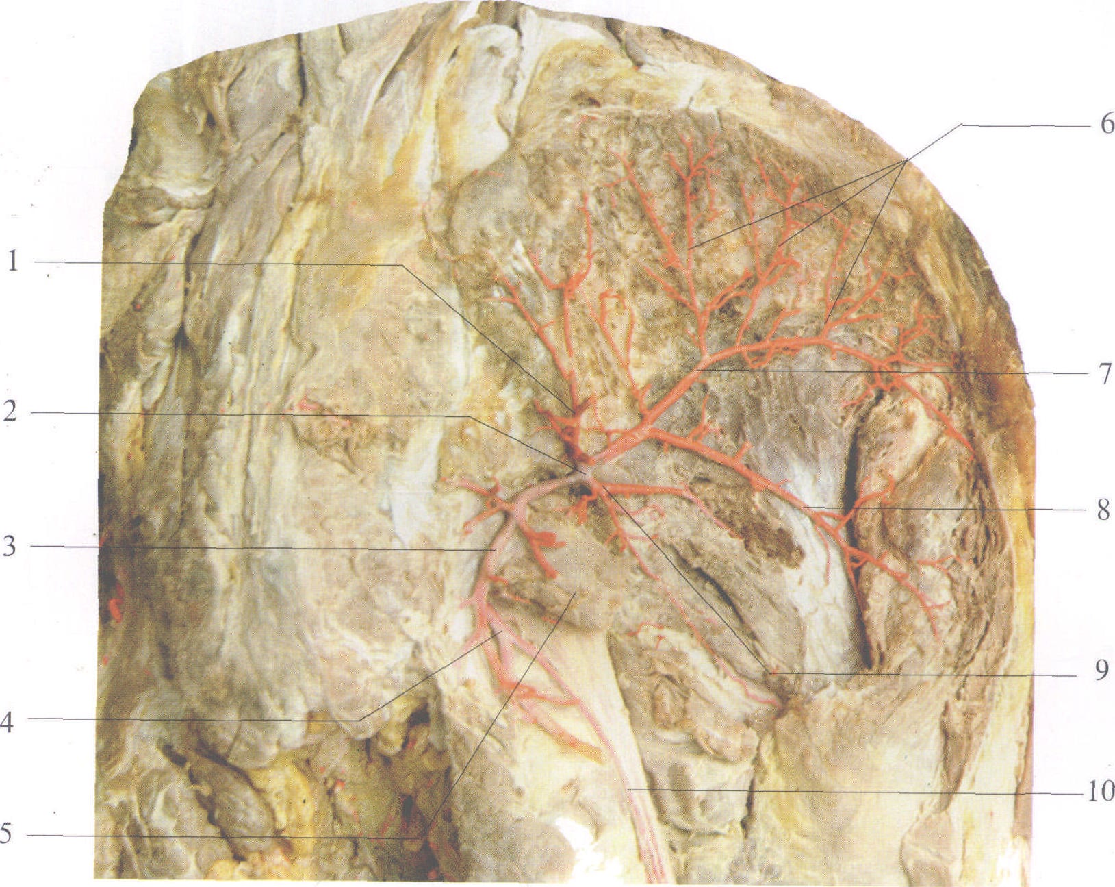 臀部血管解剖图图片