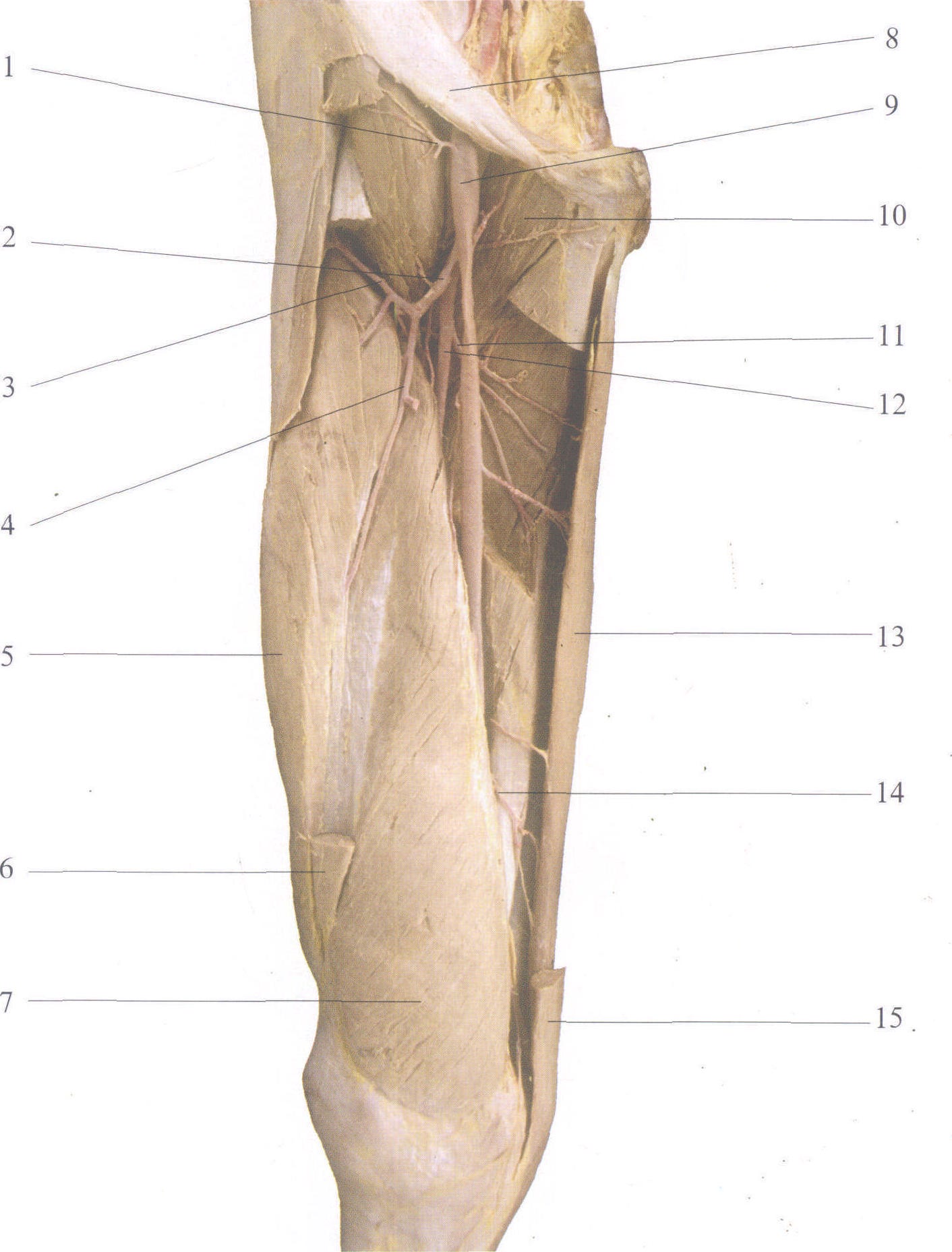 femoral artery图片