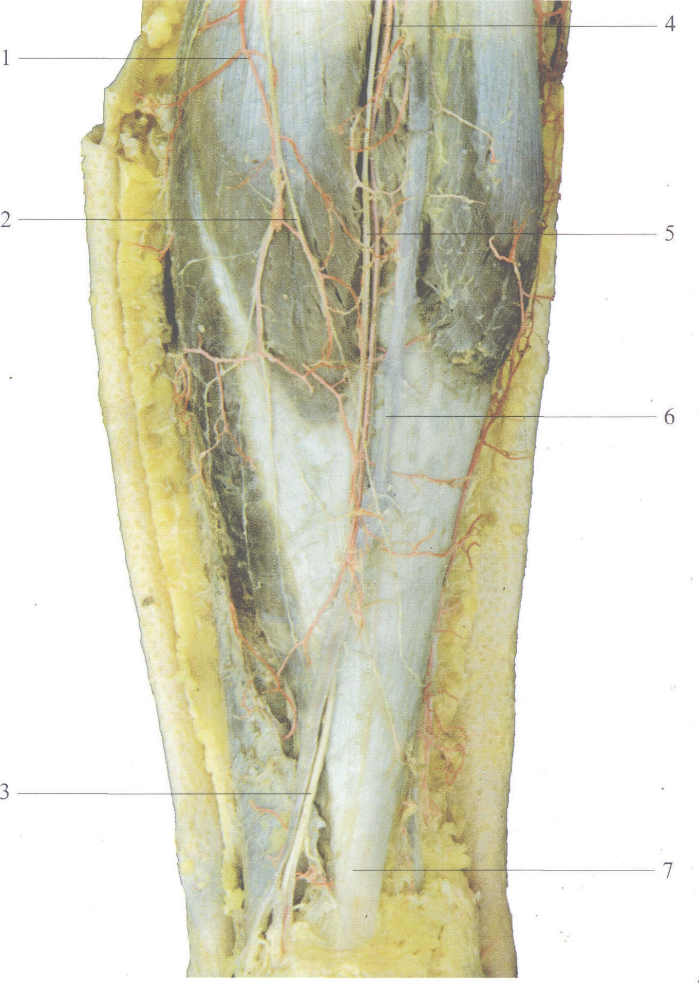 图4-119 小腿后下部浅血管、皮神经(1)