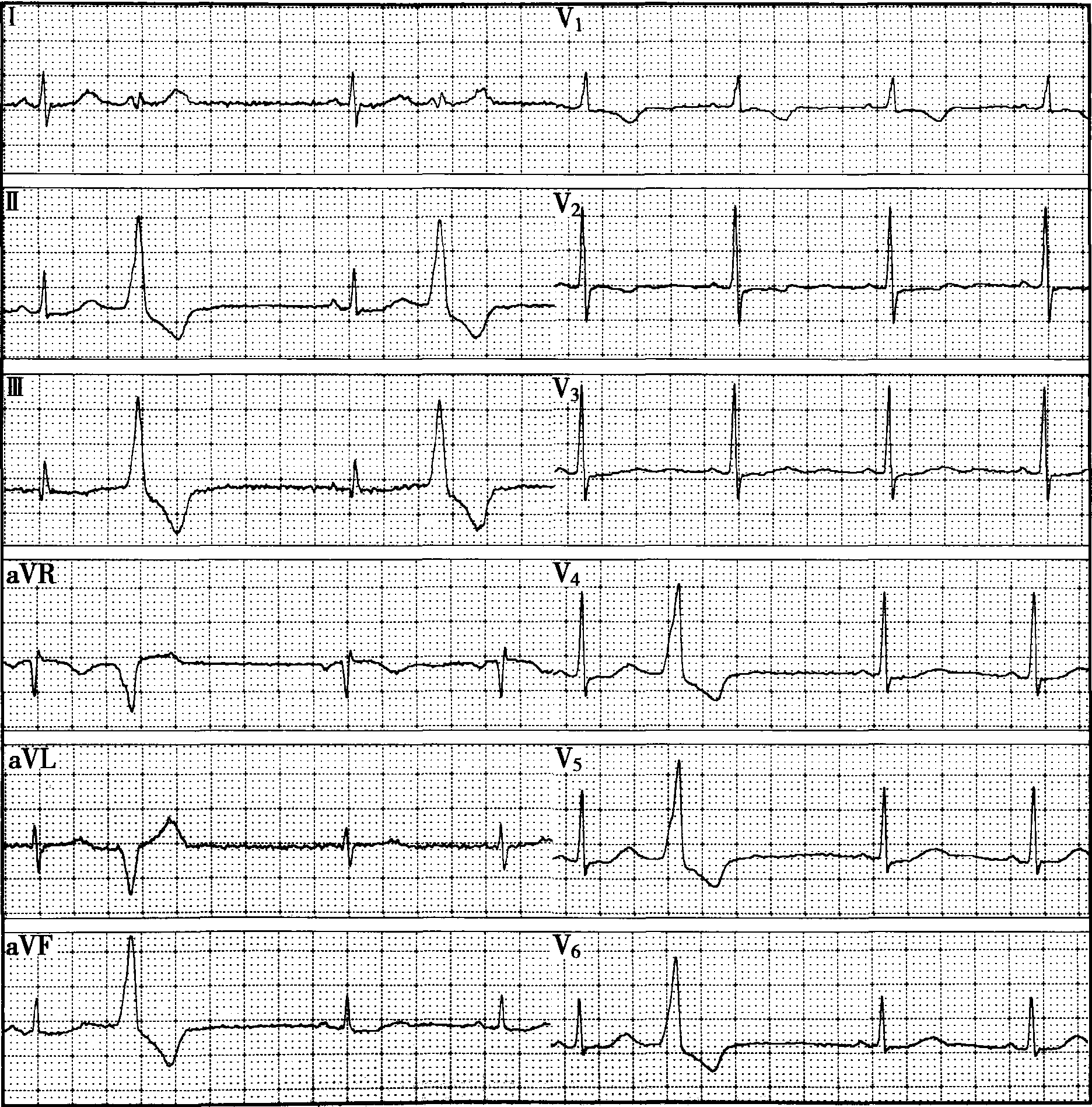 病例17