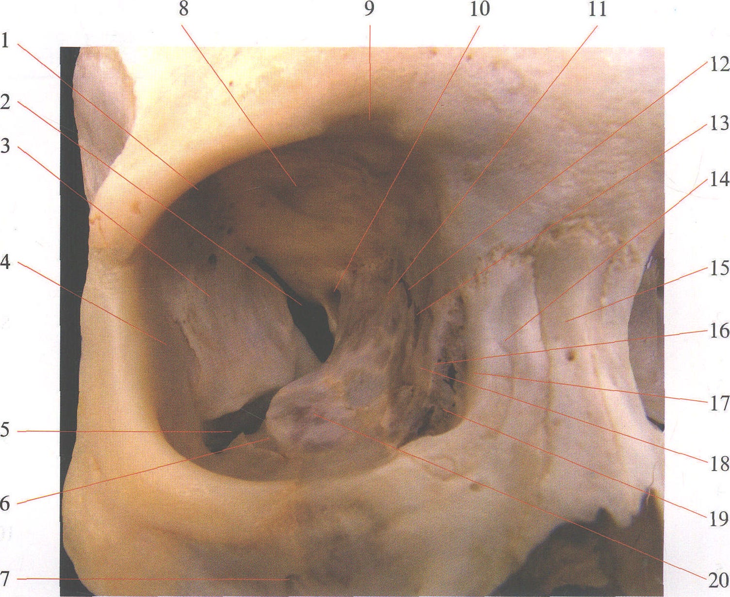 图1—2 骨性眶腔前面观