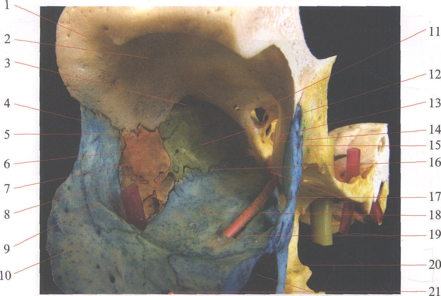 图1—6 眶腔内侧壁