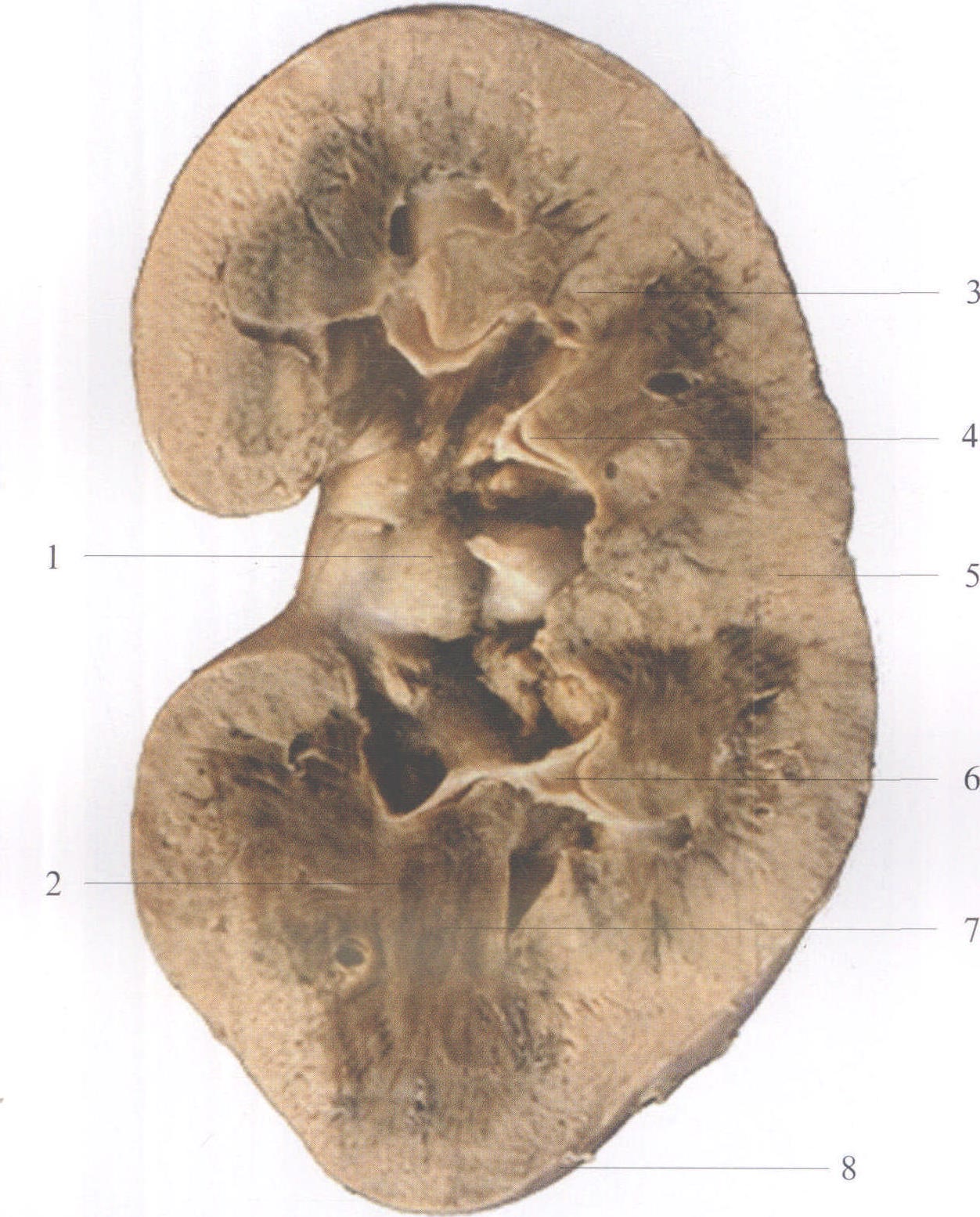 肾的冠状切面图图片