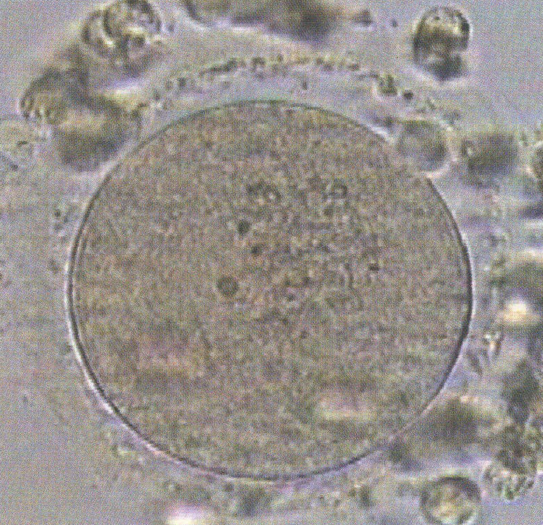 图2-29 胞浆含小包涵体的MⅡ期卵子