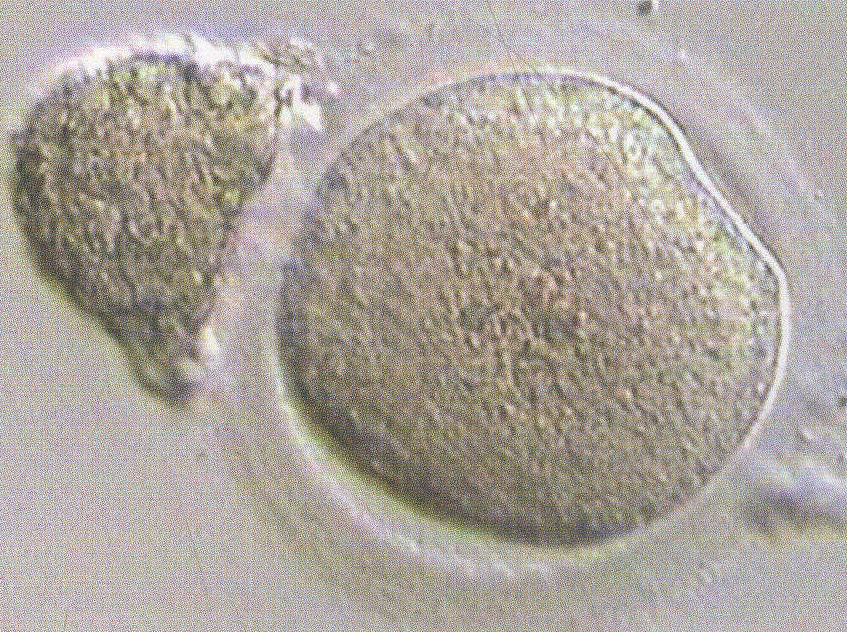 图2-34 含多余胞浆的异常卵子