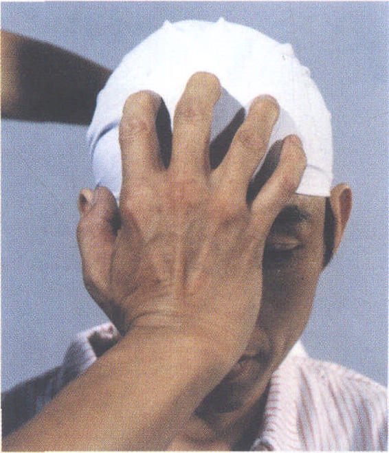 一、捋順法