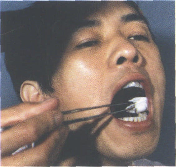 四、撬壓法