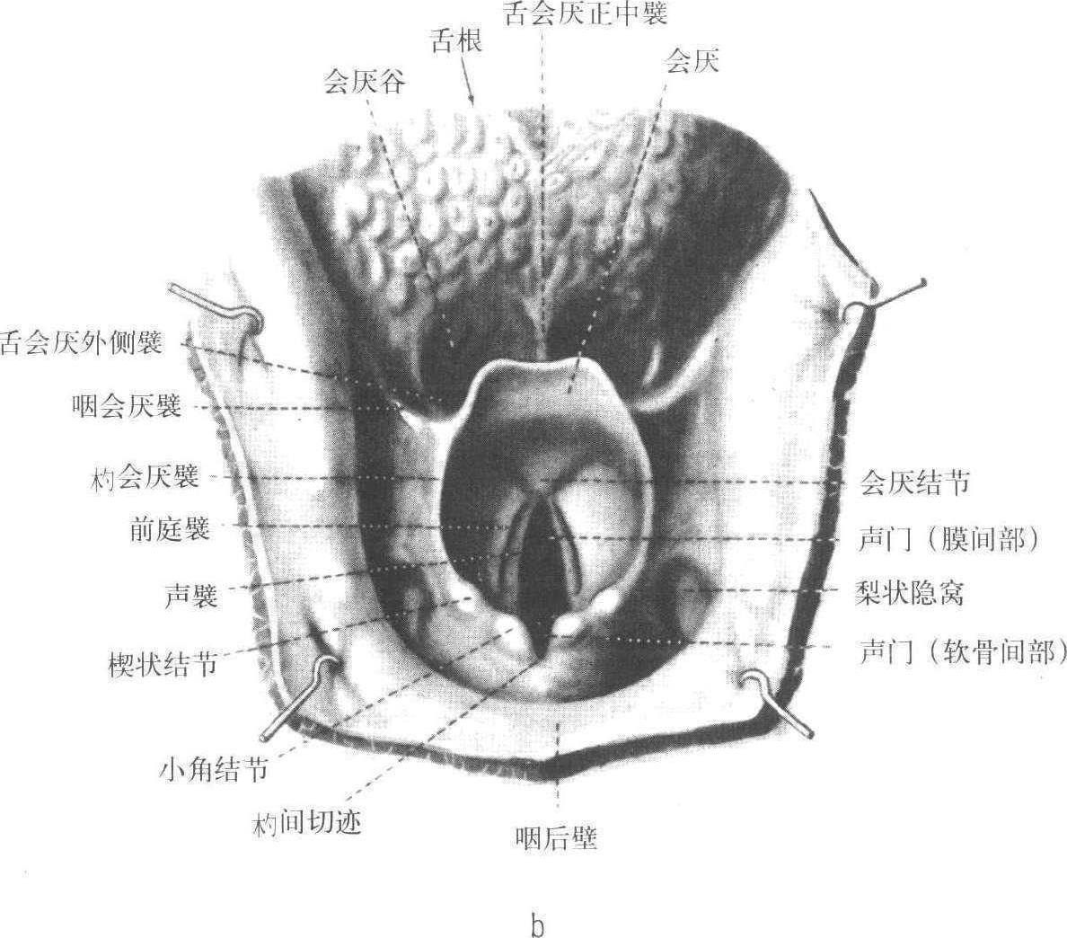 喉的解剖结构图高清图片