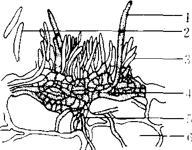 刺盘孢属