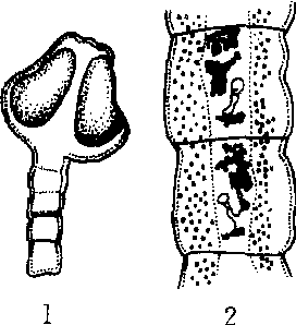 九江头槽绦虫图片