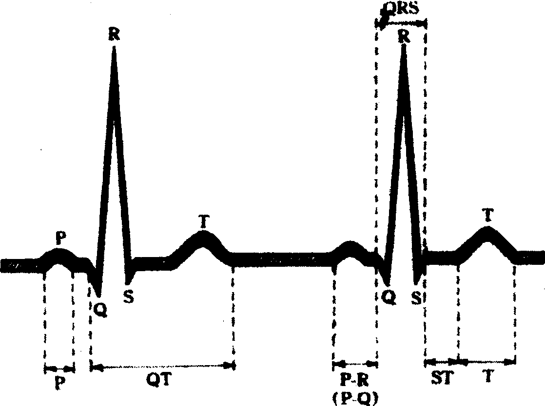 3.1 各波段时程与心率的检测
