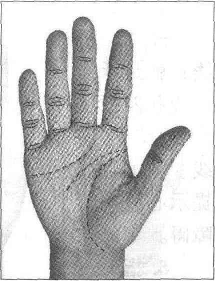 7.指节屈褶纹