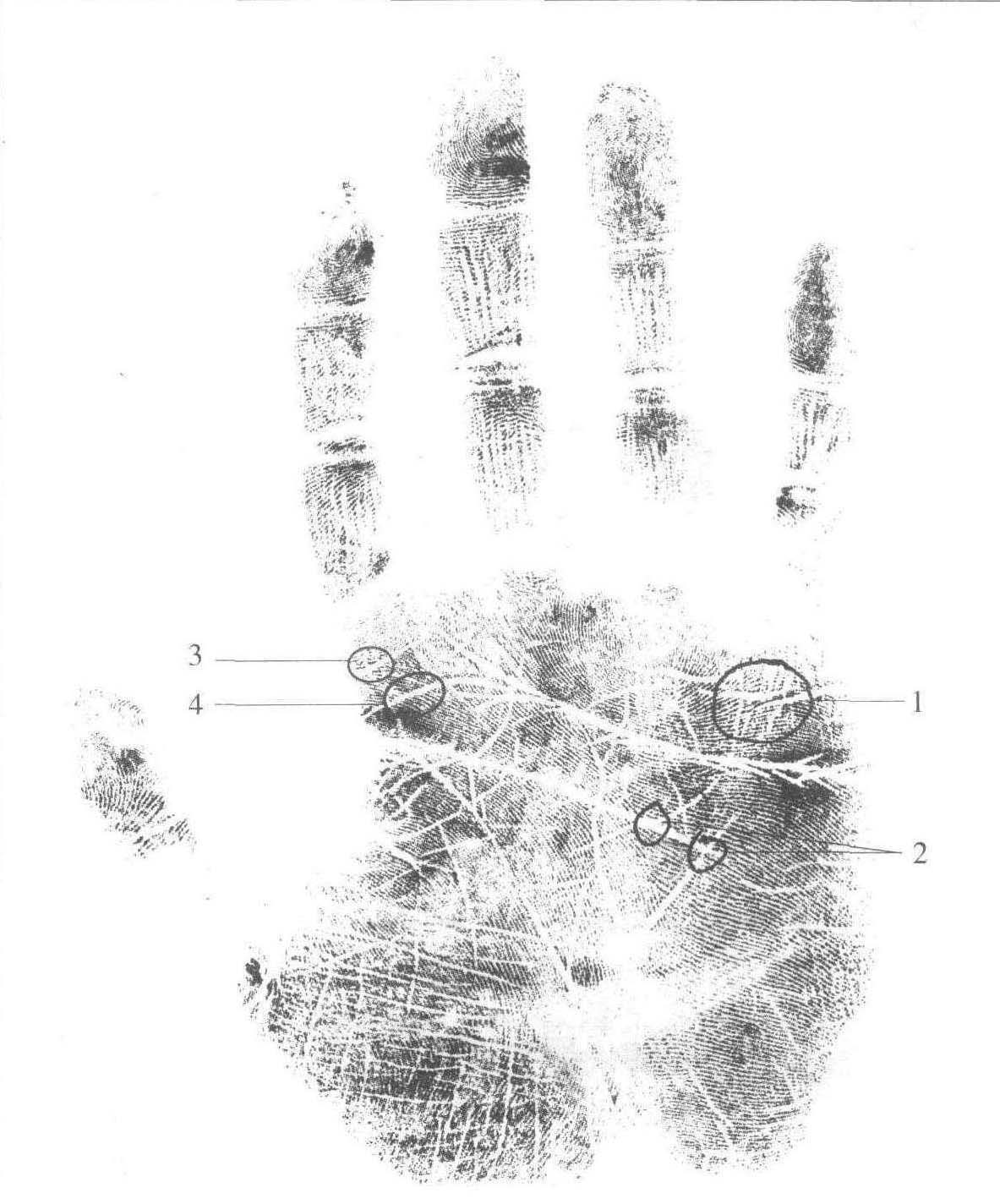 頭痛，神經(jīng)衰弱