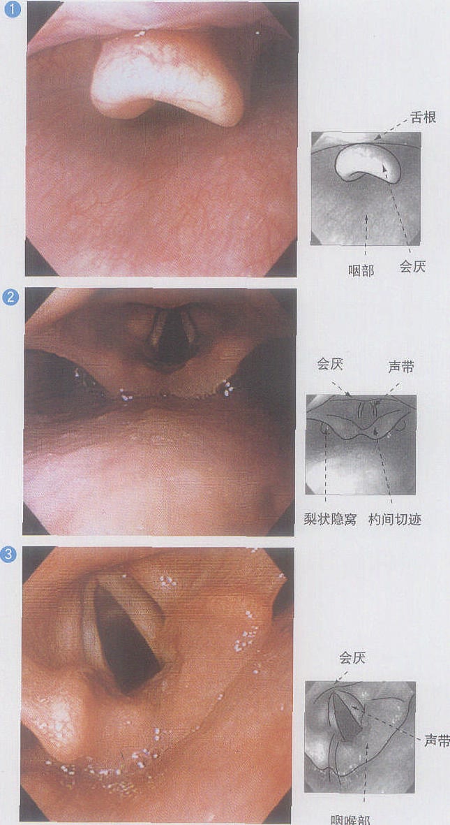 1. 咽部、喉部的解剖及鏡下所見