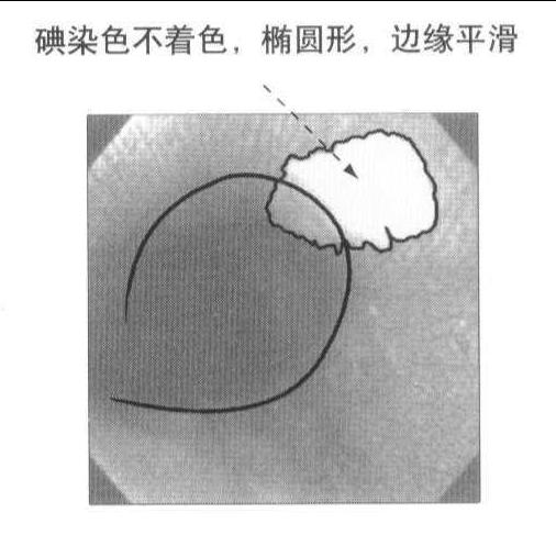 (1) 有顏色變化的病變