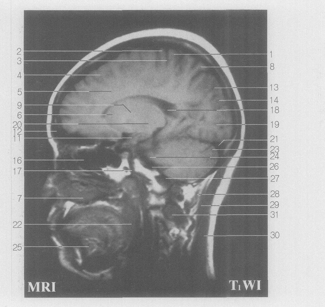 Fig SC 5