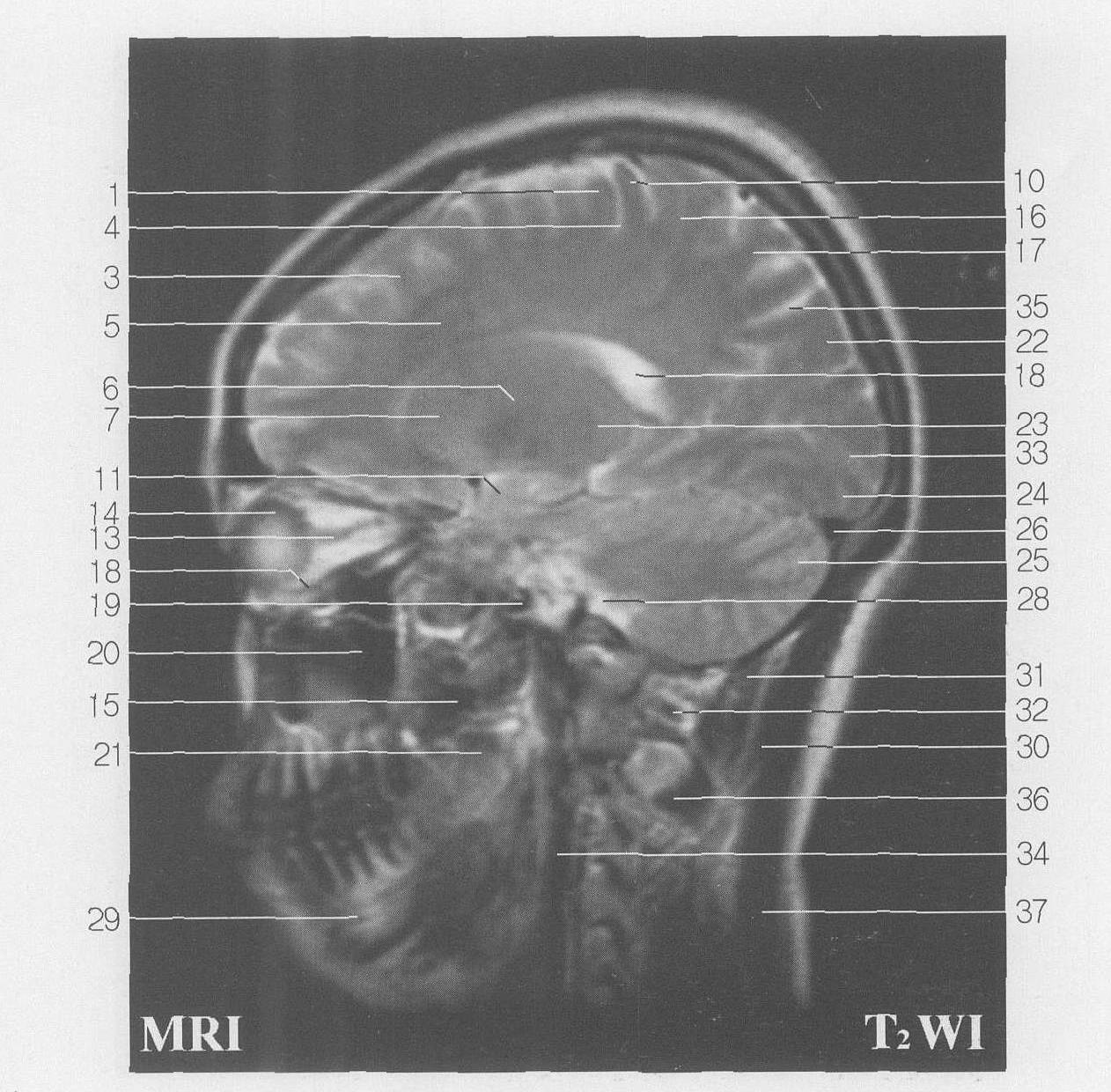 Fig SC 9