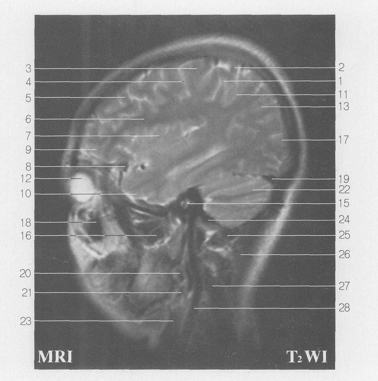 Fig SC 11