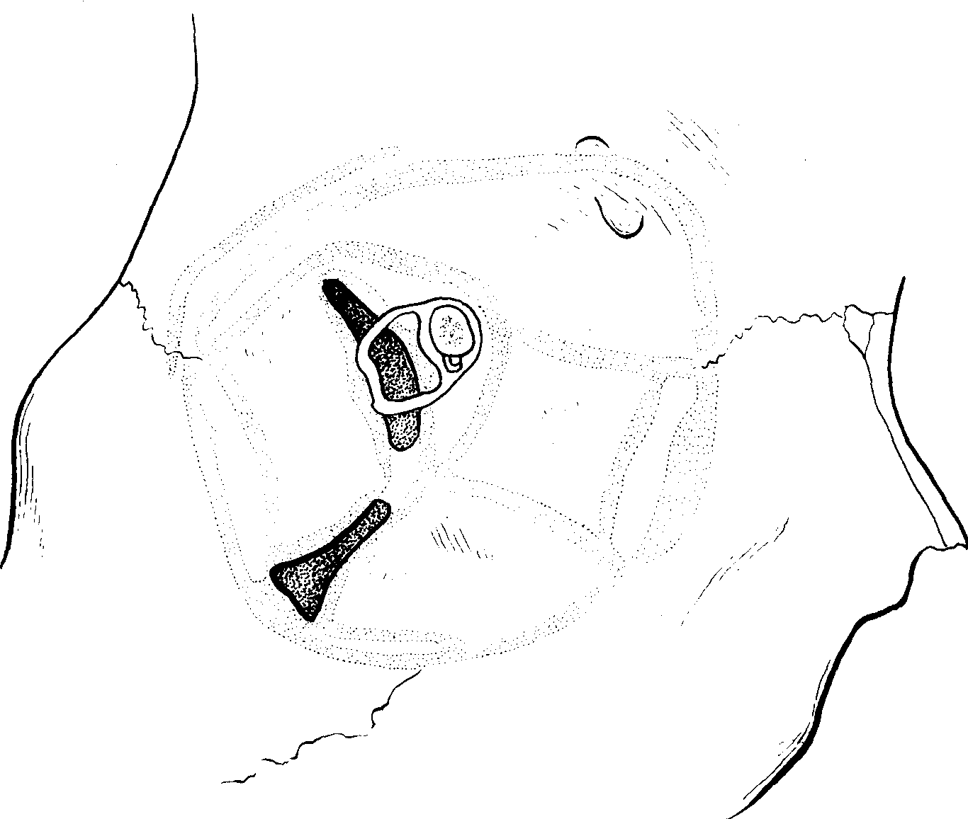 1.眶骨膜