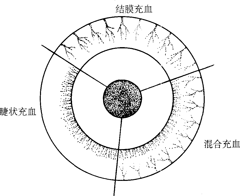 七、眼瞼、結(jié)膜組織解剖的臨床應(yīng)用