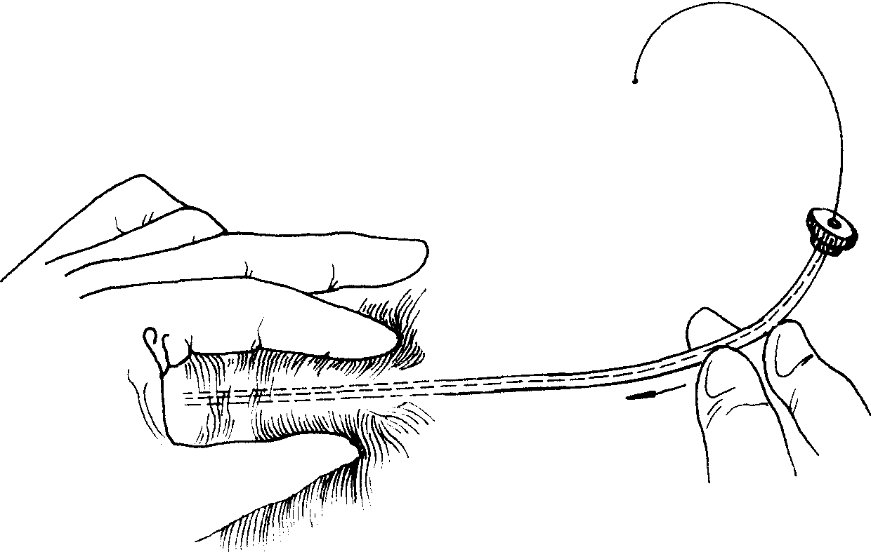 第十三節(jié) 腎與腹主動(dòng)脈造影
