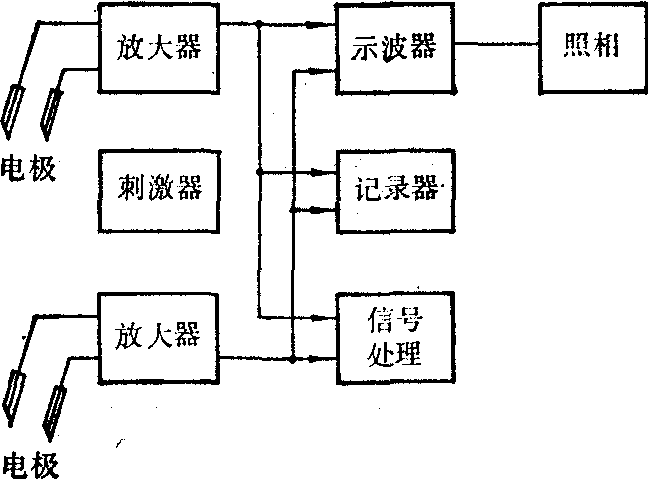 肌電測量