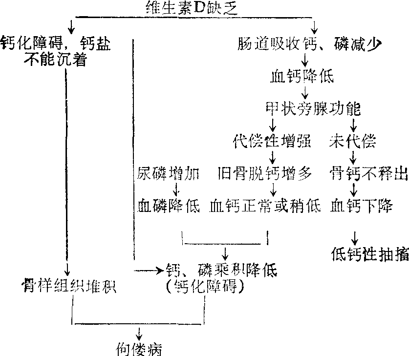 维生素D缺乏性佝偻病