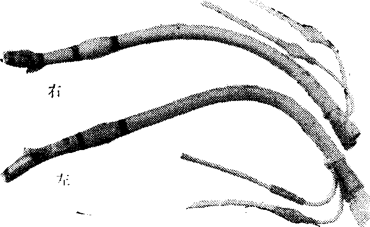 氣管與支氣管內(nèi)插管術(shù)