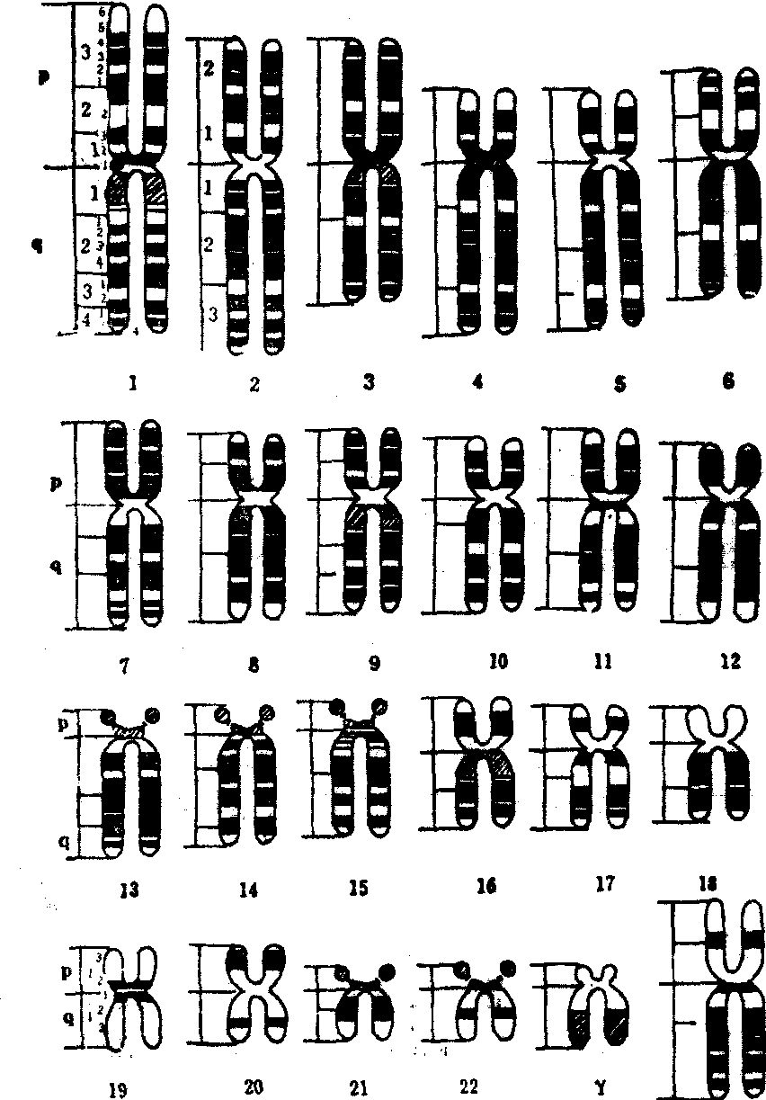 染色体核型