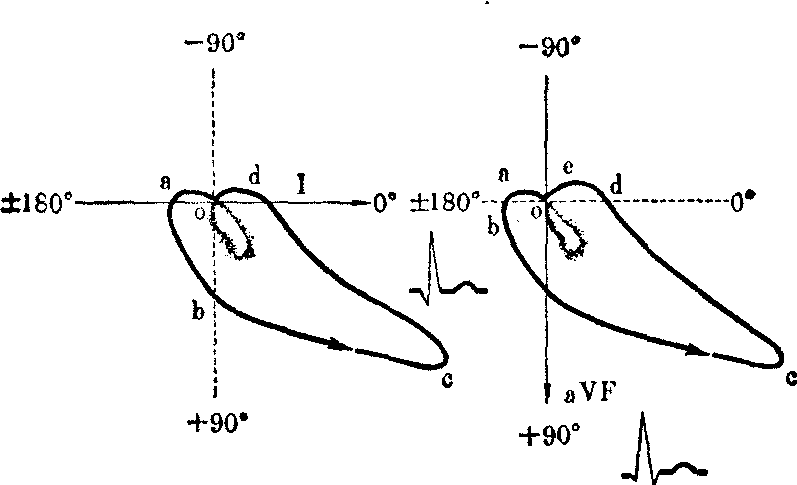 心电图、心向量图产生原理