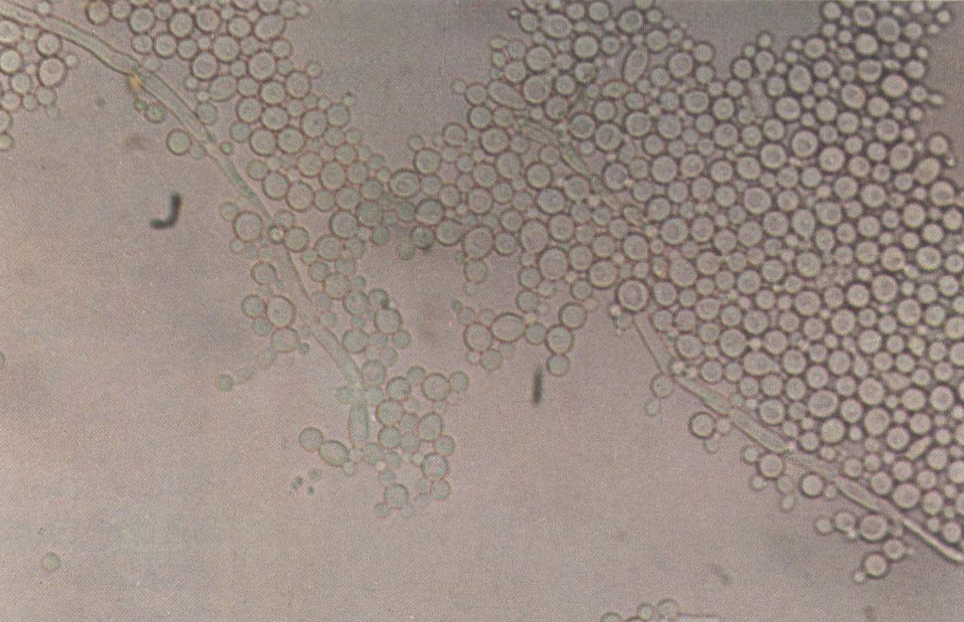 白色念珠菌孢子图片