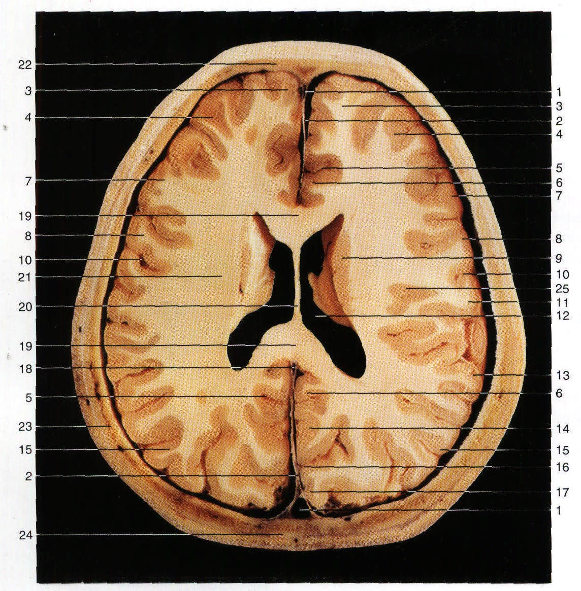 Fig.HC 5