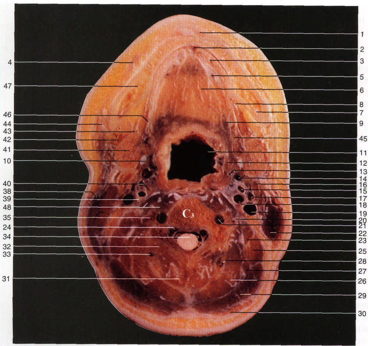 Fig.HC 17
