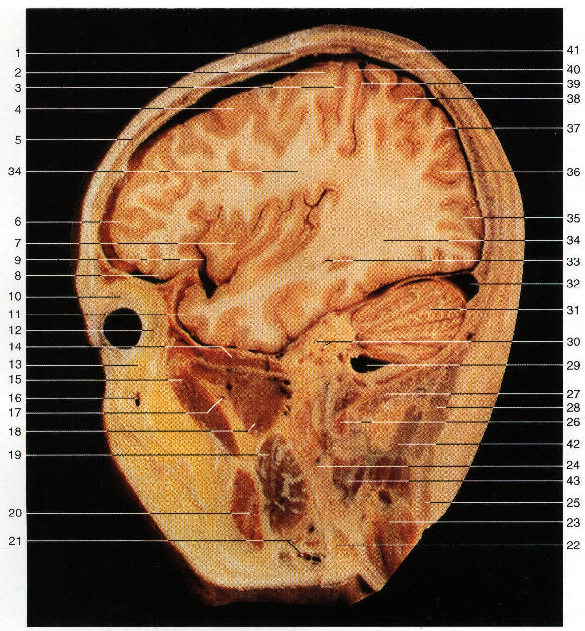 Fig.SC 3