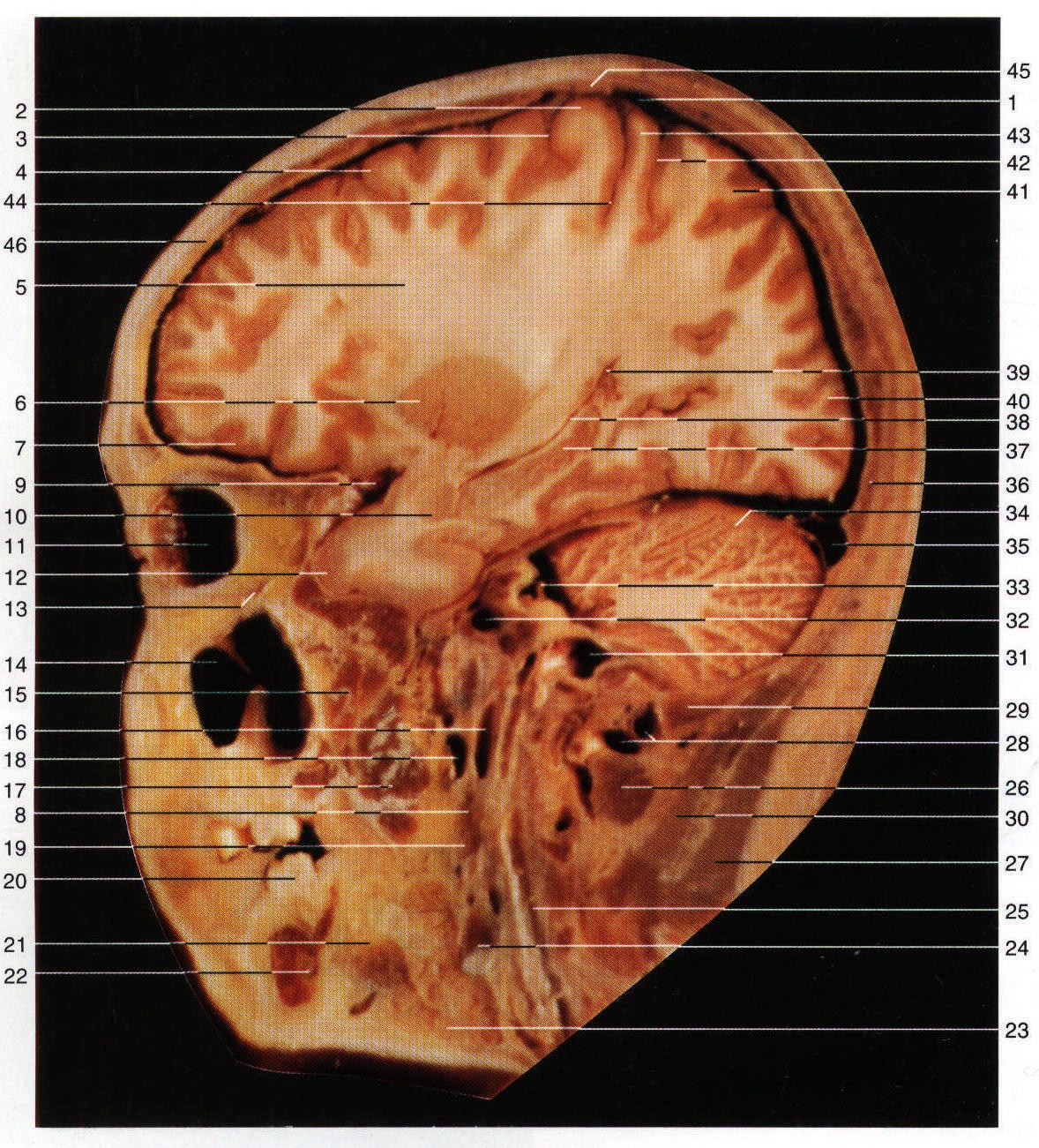 Fig.SC 4