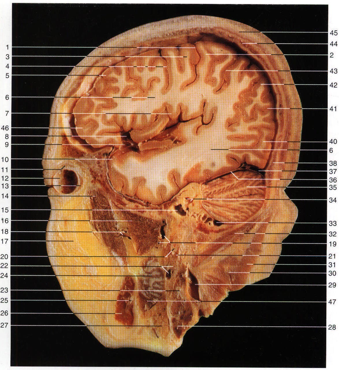 Fig.SC 11