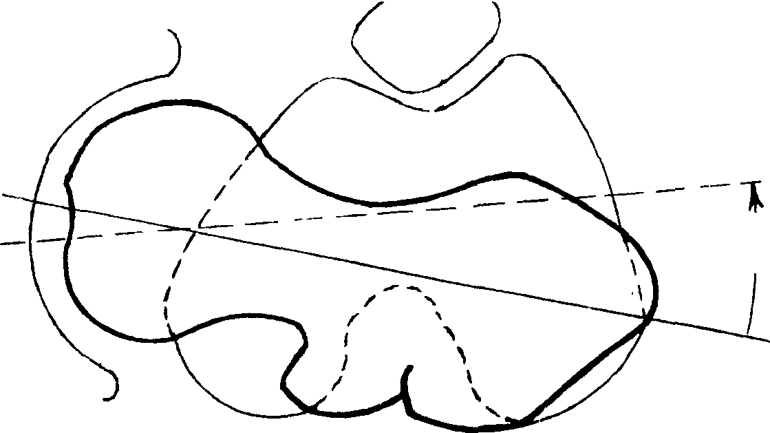 一、髖關(guān)節(jié)及股骨上段