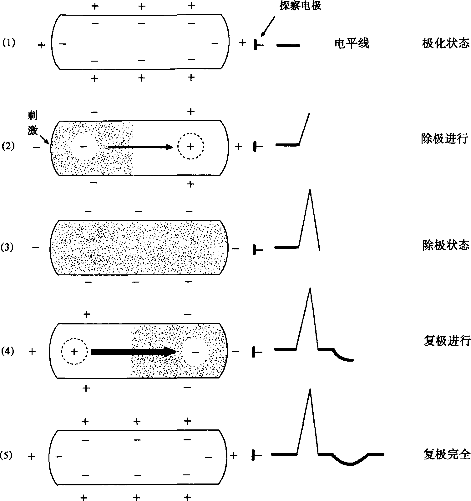 (一) 心肌細(xì)胞的除極與復(fù)極