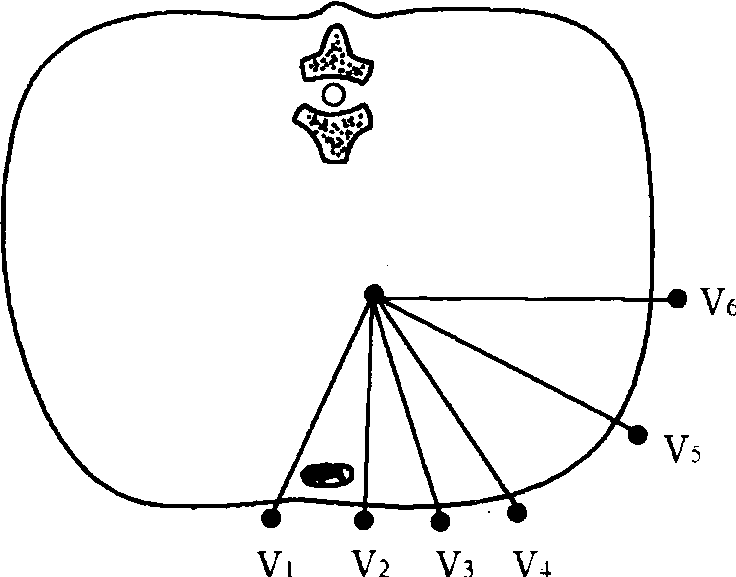 (二) 橫面上各胸導(dǎo)聯(lián)間的關(guān)系