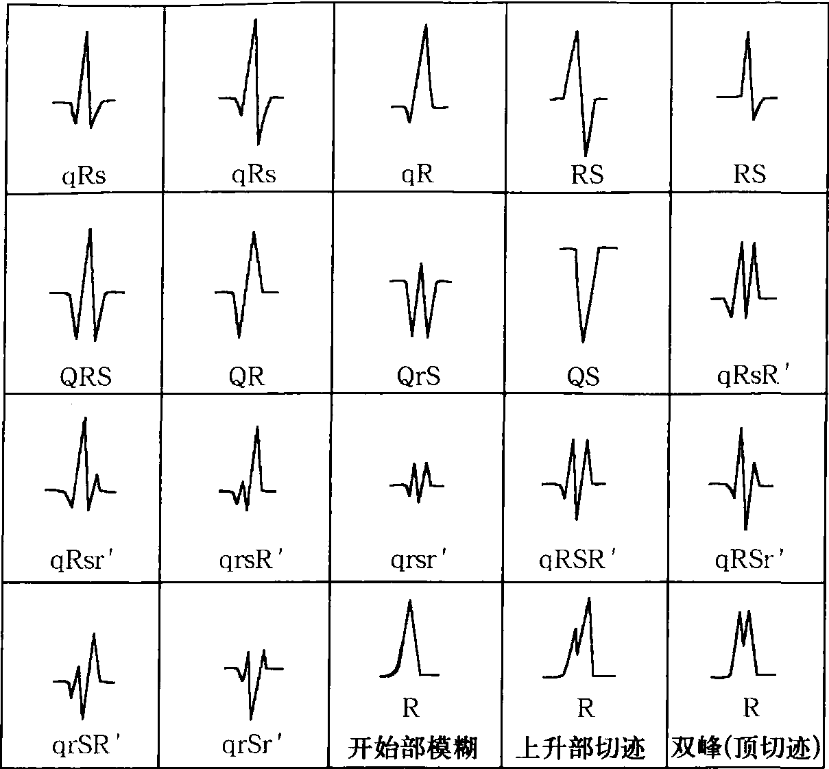 (二) QRS時間與波幅