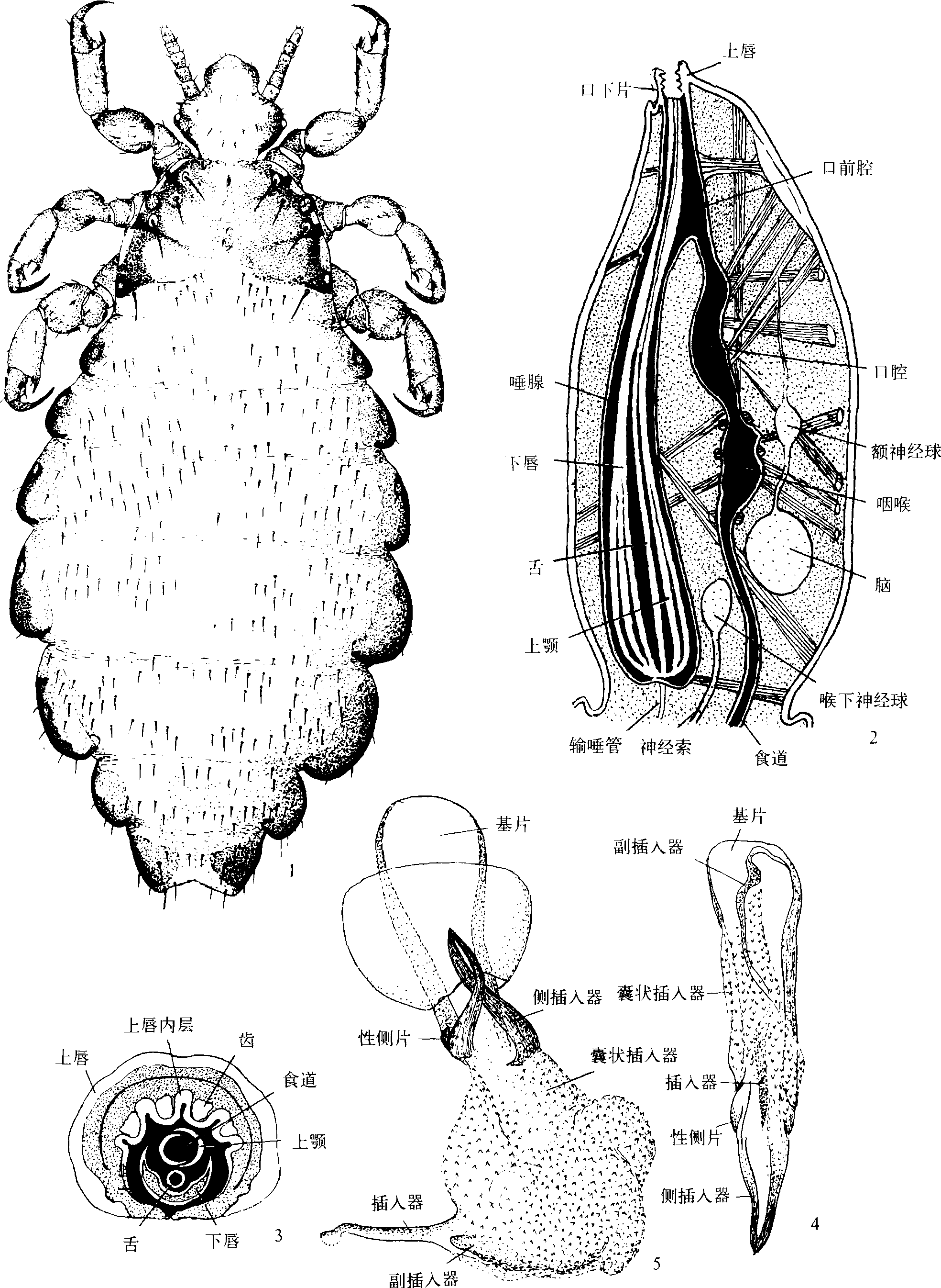 (一)头虱