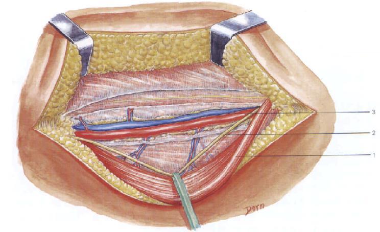 【解剖】收肌管上起股三角顶点,下至收肌腱裂孔
