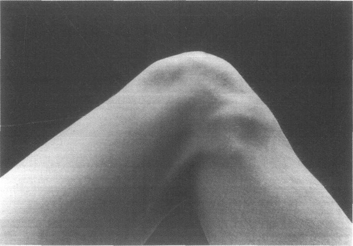 外側(cè)腔隙