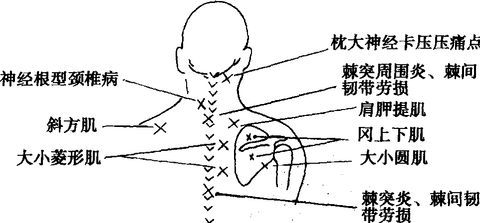 二、觸診
