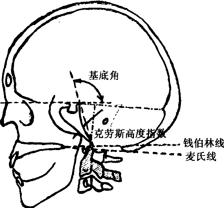 二、病理類型及診斷要點