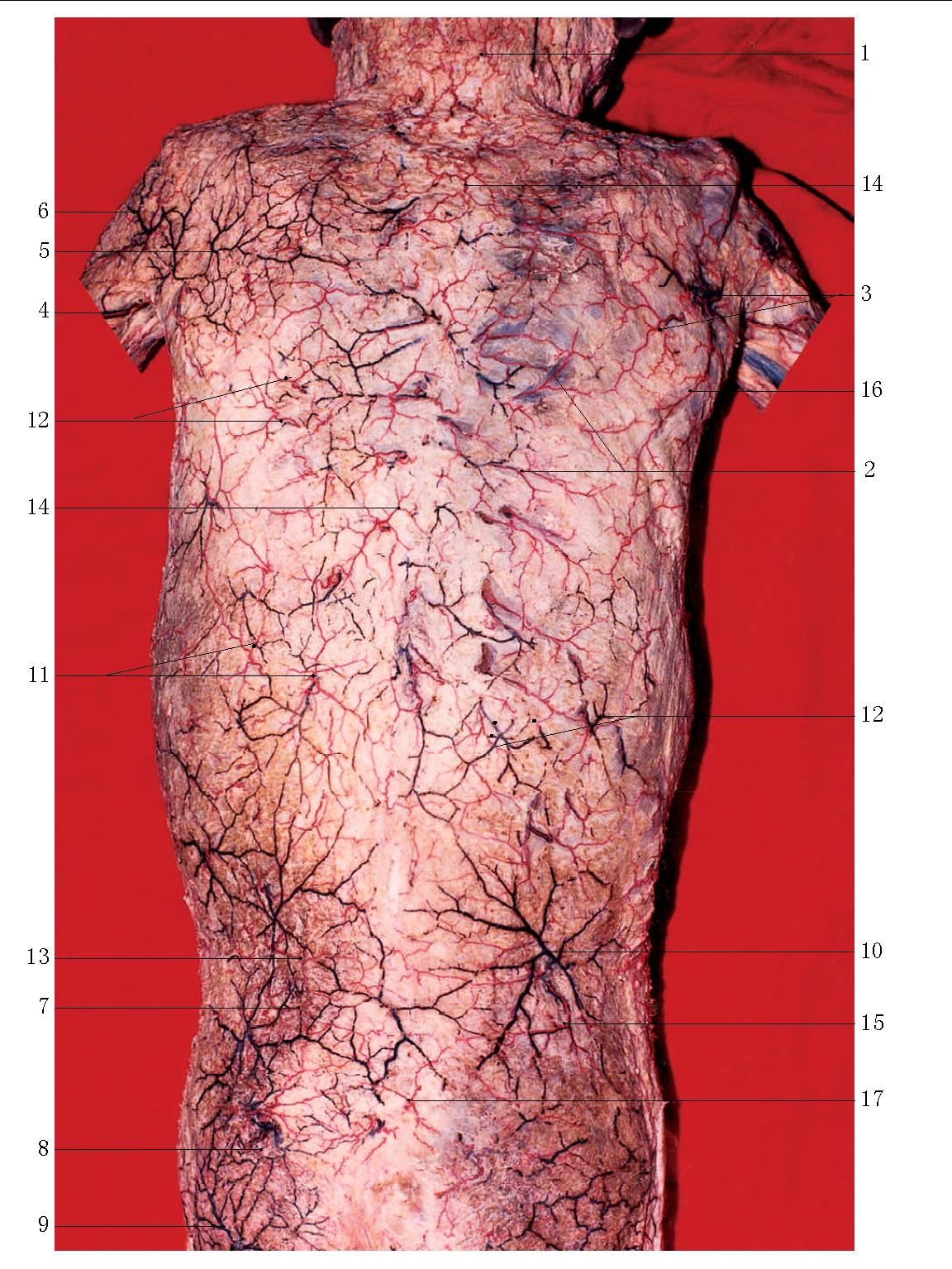 scapular spine图片