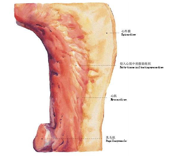 23.左室心肌脂肪浸潤