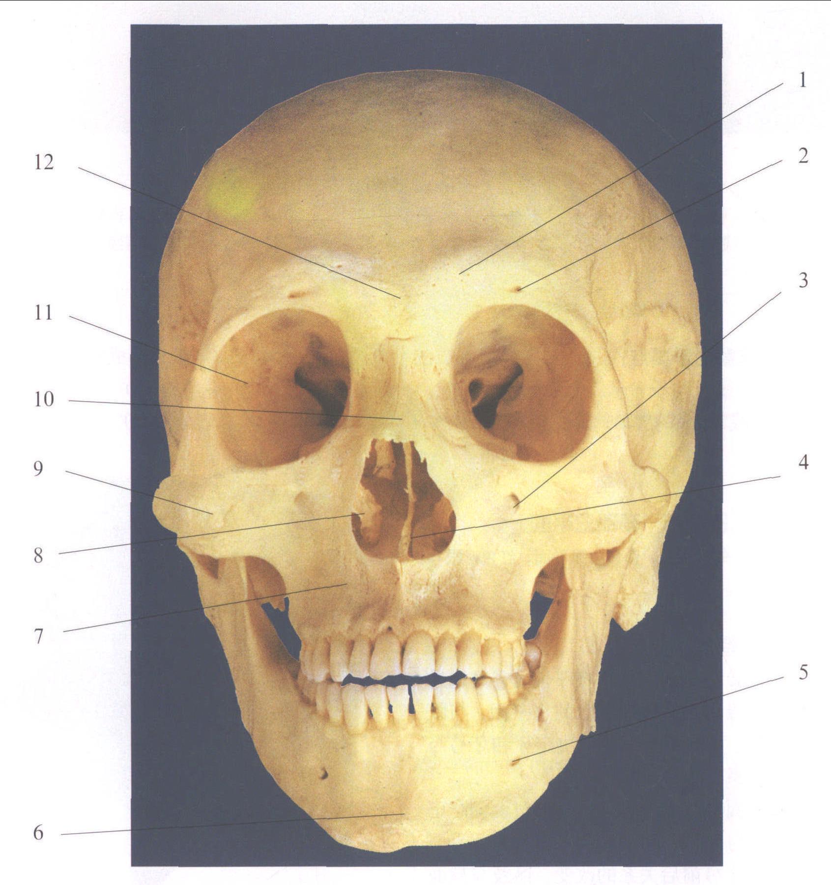 图2-6 颅骨前面观